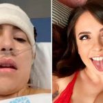 Modelo de OnlyFans siguió trabajando desde hospital tras cirugía cerebral