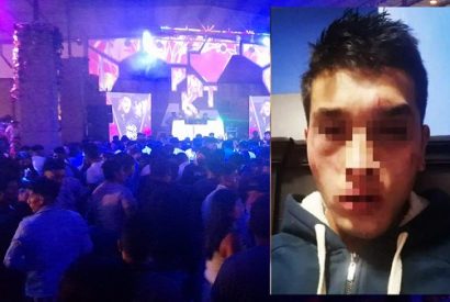 Joven fue agredido y asaltado dentro de discoteca en Huaral.