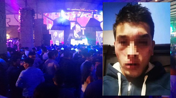 Joven fue agredido y asaltado dentro de discoteca en Huaral.